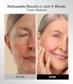 INIA Red Light Therapy Mask for Face – 4 Light Modes with 850nm NIR, Red & Blue LED Light Therapy, 2600mAh Rechargeable LED Face Mask for Radiant Glow at Home, Black - Image 3